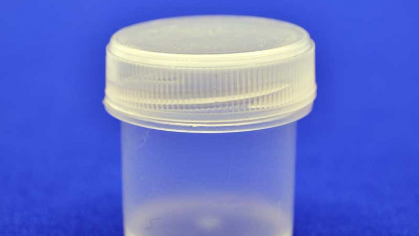 banka-z-prozorogo-plastika-10-ml-big-0
